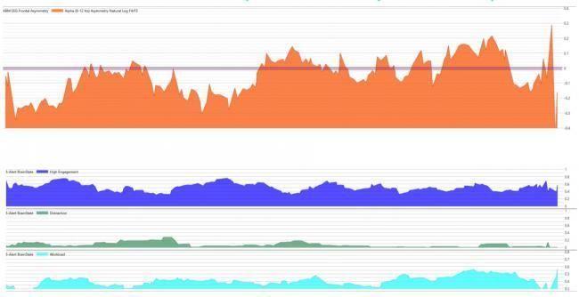 EEG data