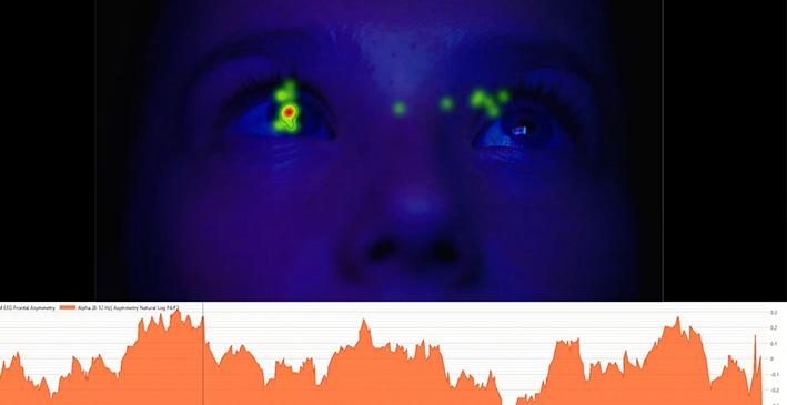 case pearle eeg screenshot 1